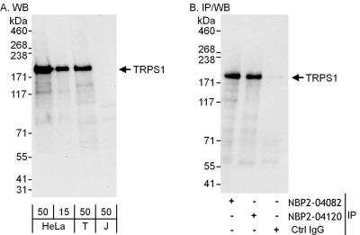 Immunoprecipitation: TRPS1 Antibody [NBP2-04120]