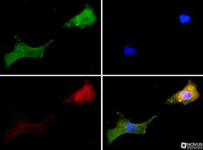 Immunocytochemistry/ Immunofluorescence: Vanilloid R1/TRPV1 Antibody - BSA Free [NBP1-97417]