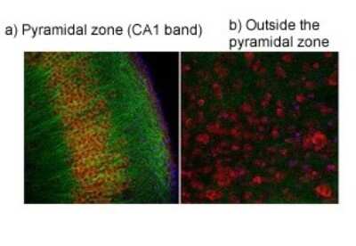 Immunohistochemistry: TRPV4 Antibody [NBP2-82366]