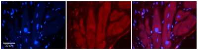 Immunohistochemistry-Paraffin: TRPV4 Antibody [NBP2-82365]