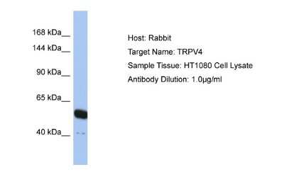 Western Blot: TRPV4 Antibody [NBP2-82365]