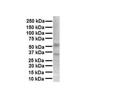 Western Blot: TRPV4 Antibody [NBP2-82365]