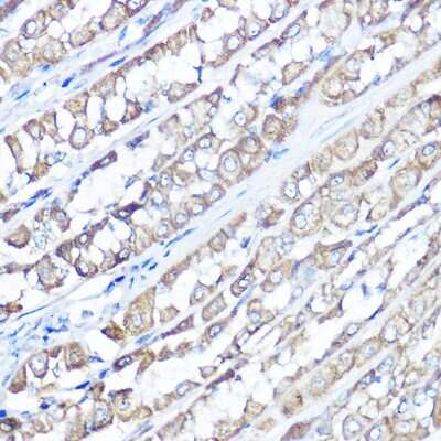 Immunohistochemistry-Paraffin: TRPV6 Antibody - Azide and BSA Free [NBP2-93876]