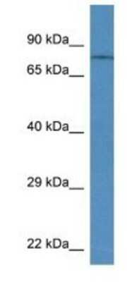 Western Blot: TRPV6 Antibody [NBP1-74138]