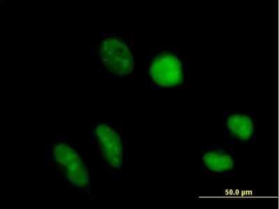 Immunocytochemistry/ Immunofluorescence: TRUB1 Antibody [H00142940-B01P]