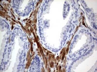Immunohistochemistry: TSC1 Antibody (OTI3A2) [NBP2-46234]
