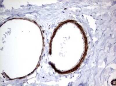Immunohistochemistry: TSC1 Antibody (OTI3A2) [NBP2-46234]