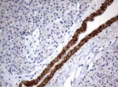 Immunohistochemistry: TSC1 Antibody (OTI3A2) [NBP2-46234]