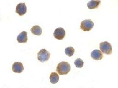 Immunocytochemistry/ Immunofluorescence: TSC1 Antibody - BSA Free [NBP1-76618]