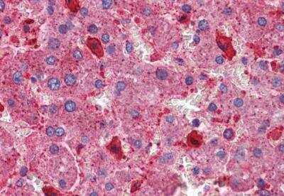 Immunohistochemistry-Paraffin: TSC1 Antibody [NB100-2821]