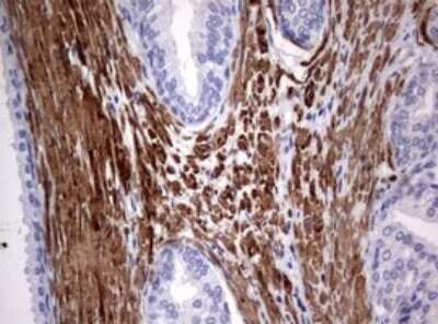 Immunohistochemistry: TSC1 Antibody (OTI3A2) - Azide and BSA Free [NBP2-74653]