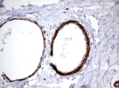 Immunohistochemistry: TSC1 Antibody (OTI3A2) - Azide and BSA Free [NBP2-74653]