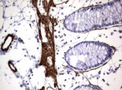Immunohistochemistry: TSC1 Antibody (OTI3A2) - Azide and BSA Free [NBP2-74653]