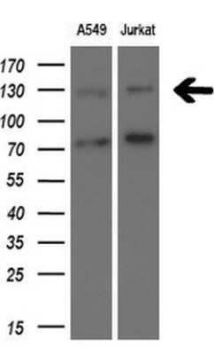 Western Blot: TSC1 Antibody (OTI3A2)Azide and BSA Free [NBP2-74653]