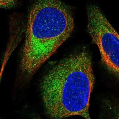 Immunocytochemistry/ Immunofluorescence: TSC2 Antibody [NBP1-82849]