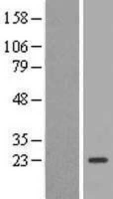 Western Blot: TSC21 Overexpression Lysate [NBL1-08418]