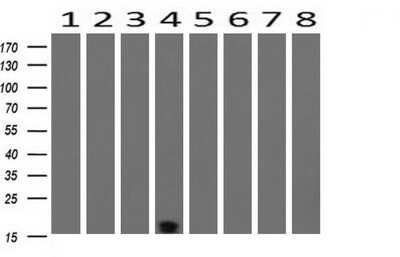 Western Blot: TSC22/TSC22D1 Antibody (OTI4H8) [NBP2-46238]