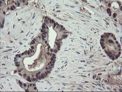 Immunohistochemistry: TSC22/TSC22D1 Antibody (OTI4H8) - Azide and BSA Free [NBP2-74654]