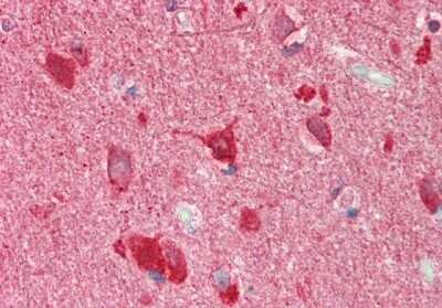 Immunohistochemistry-Paraffin: TSC22D2 Antibody [NBP2-88499]