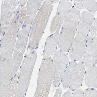 Immunohistochemistry-Paraffin: TSC22D4 Antibody [NBP1-80688]