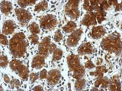 Immunohistochemistry-Paraffin: TSCOT Antibody [NBP2-15147]