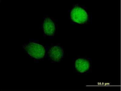Immunocytochemistry/ Immunofluorescence: TSEN2 Antibody [H00080746-B01P]