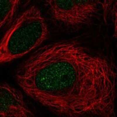 Immunocytochemistry/ Immunofluorescence: TSEN54 Antibody [NBP3-17555]