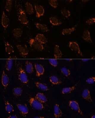 Immunocytochemistry/ Immunofluorescence: TSFM Antibody - Azide and BSA Free [NBP2-93796]