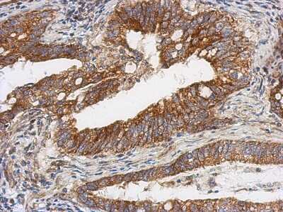 Immunohistochemistry-Paraffin: TSFM Antibody [NBP2-20746]