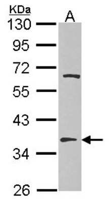 Western Blot: TSFM Antibody [NBP2-20747]