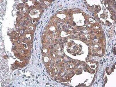 Immunohistochemistry-Paraffin: TSG101 Antibody (4A10) [NB200-112]
