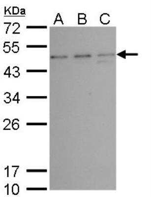 Western Blot: TSG101 Antibody (4A10) [NB200-112]