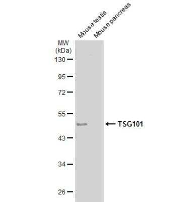 Western Blot: TSG101 Antibody (4A10) [NB200-112]