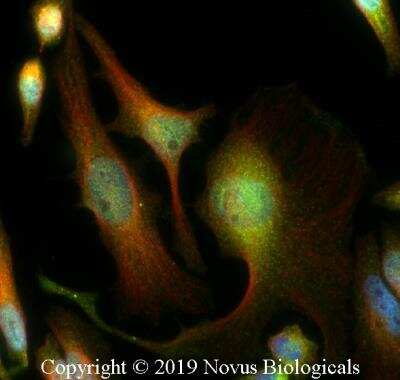 Immunocytochemistry/ Immunofluorescence: TSG101 Antibody - BSA Free [NBP2-77452]