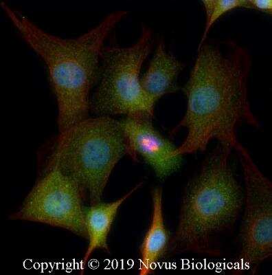 Immunocytochemistry/ Immunofluorescence: TSG101 Antibody - BSA Free [NBP2-77452]
