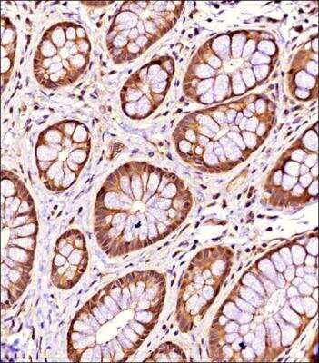 Immunohistochemistry-Paraffin: TSG101 Antibody - BSA Free [NBP2-77452]