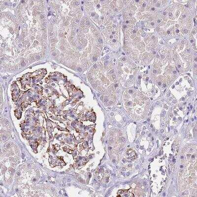 Immunohistochemistry: TSGA13 Antibody [NBP2-13488]