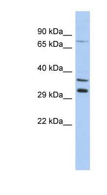 Western Blot: TSGA13 Antibody [NBP1-70739]