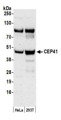 Western Blot: TSGA14 Antibody [NB100-93339]