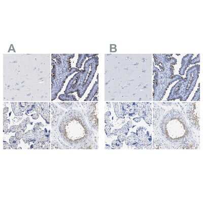 Immunohistochemistry-Paraffin: TSGA2 Antibody [NBP1-89839]