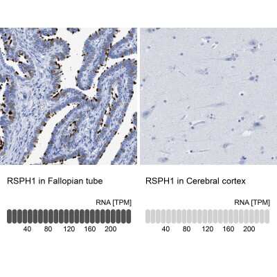Immunohistochemistry-Paraffin: TSGA2 Antibody [NBP1-89840]