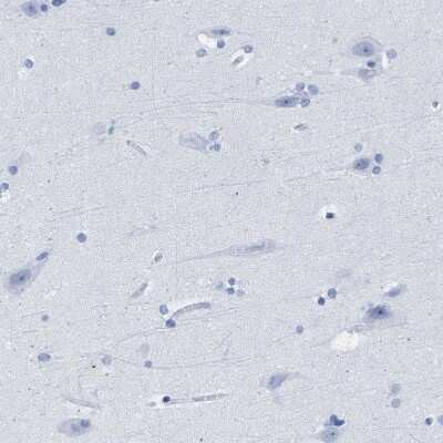 Immunohistochemistry-Paraffin: TSGA2 Antibody [NBP1-89840]