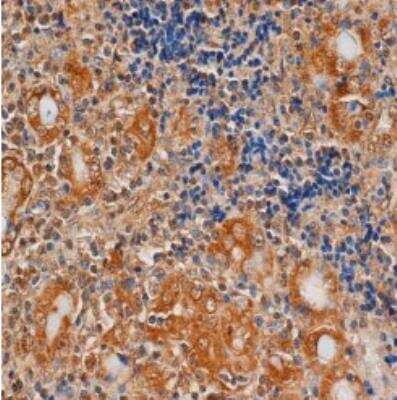 Immunohistochemistry-Paraffin: TSHR Antibody (4C1) - BSA Free [NB100-65797]