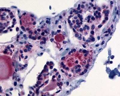 Immunohistochemistry-Paraffin: TSHR Antibody - BSA Free [NLS1449]