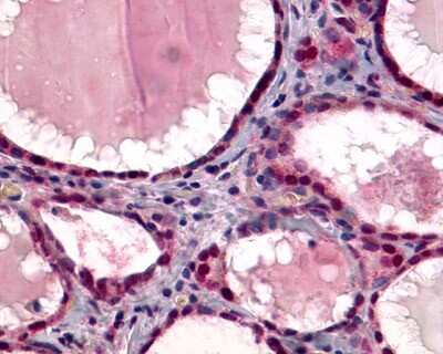 Immunohistochemistry-Paraffin: TSHR Antibody - BSA Free [NLS1449]