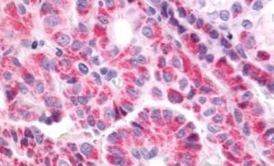Immunohistochemistry-Paraffin: TSHR Antibody - BSA Free [NLS1449]