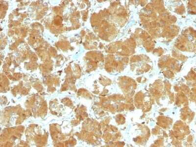 Immunohistochemistry-Paraffin: TSHR Antibody (TSHRA/1402) - Azide and BSA Free [NBP2-54343]