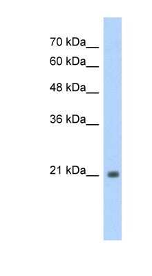 Western Blot: TSHR Antibody [NBP1-53167]