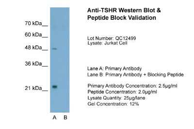 Western Blot: TSHR Antibody [NBP1-53167]