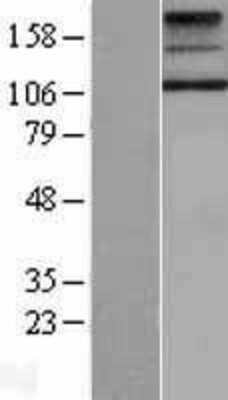 Western Blot: TSHR Overexpression Lysate [NBL1-17361]